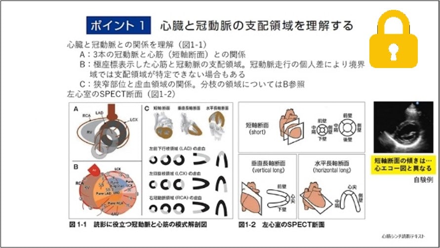 読影道場  谷口 琢也 先生 (市立大津市民病院 循環器内科) サムネイル