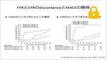 虚血評価の未来１