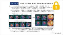 読影の基礎2　サムネイル