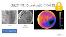 症例1　70代男性(主訴：労作時倦怠感) サムネイル